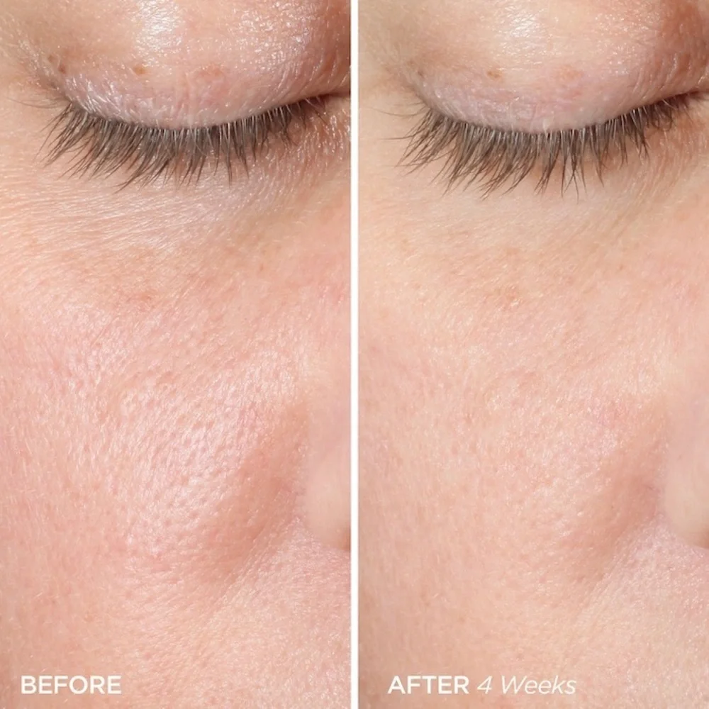 🌟 BeautyBio – The ZenBubble Bi-Phase Toner Serum (1.7 fl. oz / 50 mL) 🌟